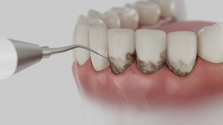 Reliable Tooth Extraction contractor in Bevil Oaks, TX by Smile Center Dentistry